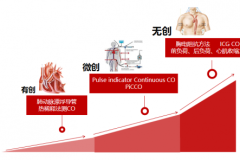血流动力学之监测选择