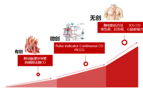 血流动力学之监测选择